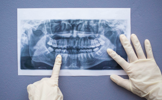 Tipuri de radiografii dentare utilizate în stomatologie